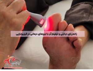 زخم پای دیابتی و ترمیم آن با لیزرهای درمانی در فیزیوتراپی