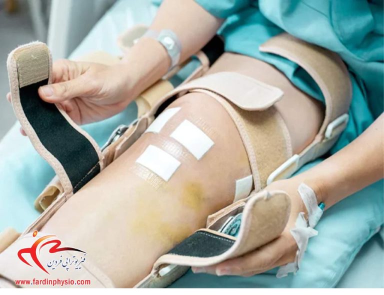 درباره این مقاله بیشتر بخوانید مراقبت‌های بعد از جراحی رباط صلیبی زانو چیست؟
