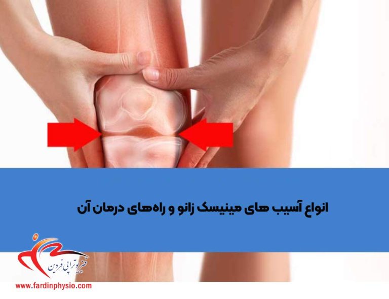 درباره این مقاله بیشتر بخوانید انواع آسیب های مینیسک زانو و راه‌های درمان آن