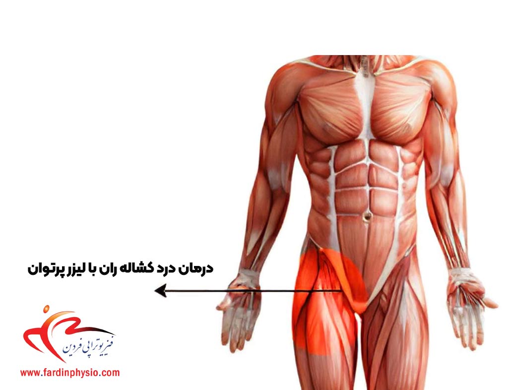 You are currently viewing درمان درد کشاله ران با لیزر پرتوان: یک رویکرد نوین در فیزیوتراپی