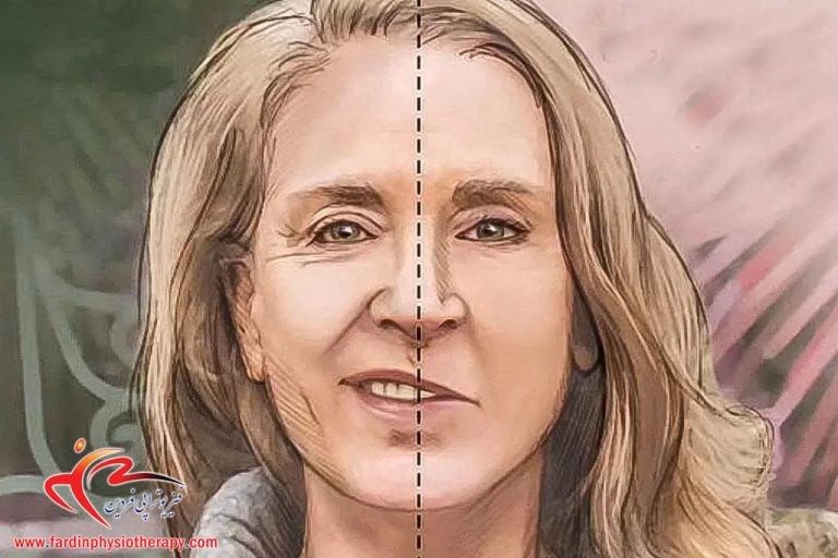 درباره این مقاله بیشتر بخوانید فیزیوتراپی برای فلج بل (فلج صورت)؛ مراحل بازتوانی و شانس بهبودی کامل