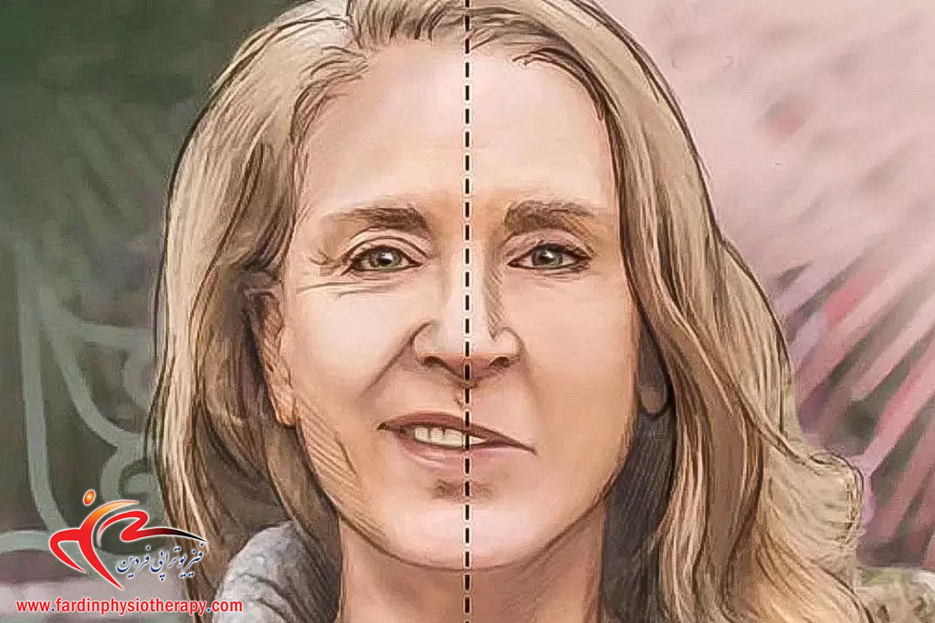 You are currently viewing فیزیوتراپی برای فلج بل (فلج صورت)؛ مراحل بازتوانی و شانس بهبودی کامل