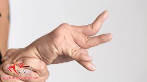فیزیوتراپی برای اسپاستیسیتی و سفتی عضلات در بیماران مبتلا به ام‌اس (MS)